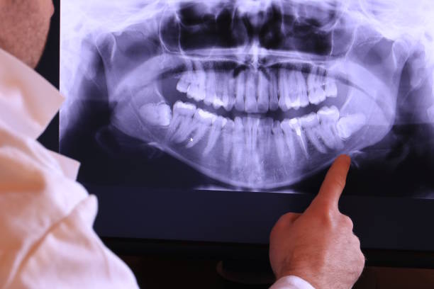 Best Emergency Root Canal Treatment in Glencoe, FL