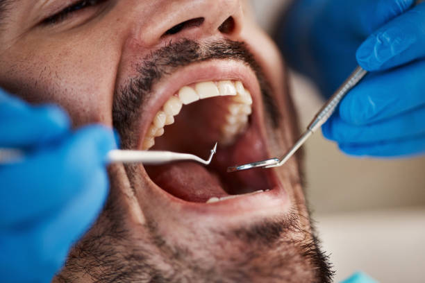 Best Urgent Care for Lost Fillings or Crowns in Glencoe, FL